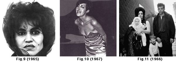 Fig9-11